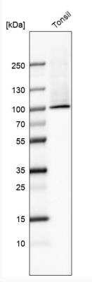 Western Blot: Transglutaminase 1/TGM1 Antibody [NBP2-34062]