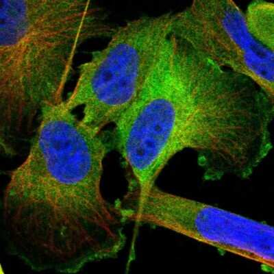 Immunocytochemistry/ Immunofluorescence: Transglutaminase 2/TGM2 Antibody [NBP1-86951]
