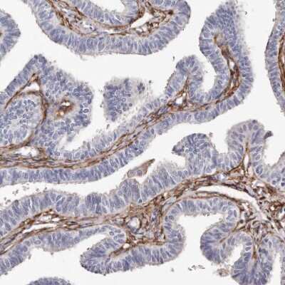Immunohistochemistry-Paraffin: Transglutaminase 2/TGM2 Antibody [NBP1-86951]