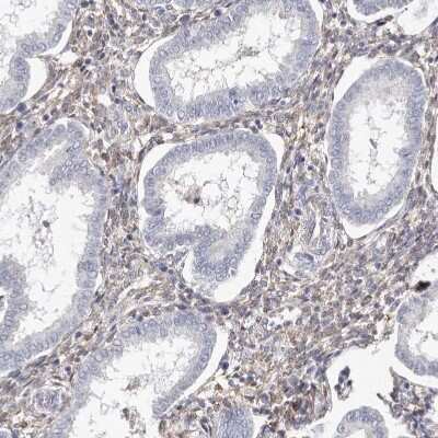 Immunohistochemistry-Paraffin: Transglutaminase 2/TGM2 Antibody [NBP1-86951]
