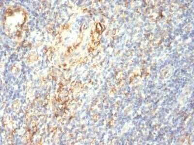Immunohistochemistry-Paraffin: Transglutaminase 2/TGM2 Antibody (TGM2/419) - IHC-Prediluted [NBP2-48083]