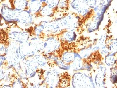Immunohistochemistry-Paraffin: Transglutaminase 2/TGM2 Antibody (TGM2/419) [NBP2-44594]