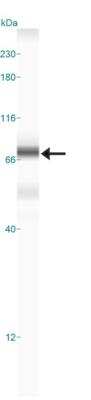 Simple Western: Transglutaminase 2/TGM2 Antibody [NBP2-24470]