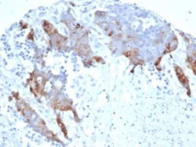 Immunohistochemistry-Paraffin: Transglutaminase 2/TGM2 Antibody (TGM2/6943R) [NBP3-13790]