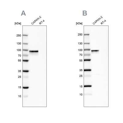 Western Blot: Transglutaminase 2/TGM2 Antibody [NBP1-86951]