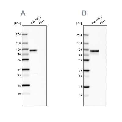 Western Blot: Transglutaminase 2/TGM2 Antibody [NBP1-86952]