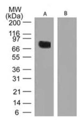 Western Blot: Transglutaminase 2/TGM2 Antibody [NBP2-24470]