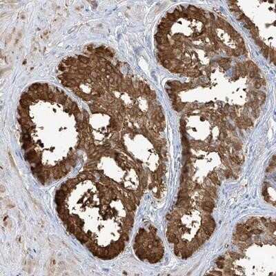 Immunohistochemistry-Paraffin: Transglutaminase 4/TGM4 Antibody [NBP1-86947]