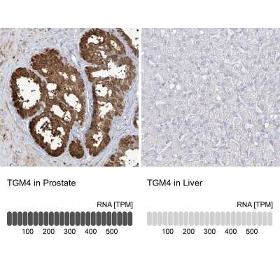 Immunohistochemistry-Paraffin: Transglutaminase 4/TGM4 Antibody [NBP1-86947]