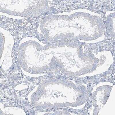 Immunohistochemistry-Paraffin: Transglutaminase 4/TGM4 Antibody [NBP1-86947]