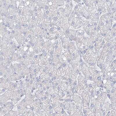 Immunohistochemistry-Paraffin: Transglutaminase 4/TGM4 Antibody [NBP1-86947]