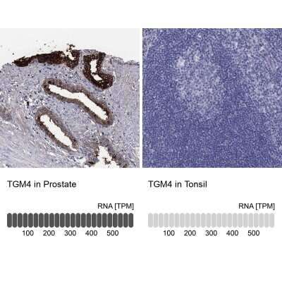 Immunohistochemistry-Paraffin: Transglutaminase 4/TGM4 Antibody [NBP3-17095]