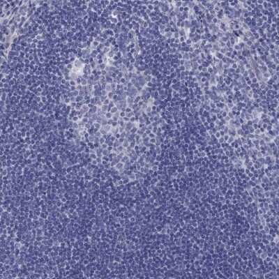 Immunohistochemistry-Paraffin: Transglutaminase 4/TGM4 Antibody [NBP3-17095]