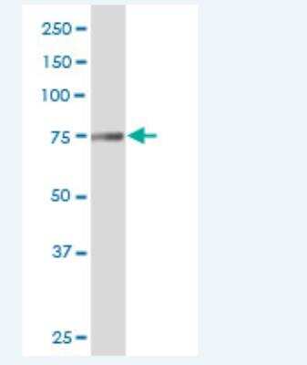 Western Blot: Transglutaminase 7/TGM7 Antibody [H00116179-B01P-50ug]