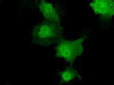 Immunocytochemistry/ Immunofluorescence: Transketolase Antibody (OTI5H3) [NBP2-02292]