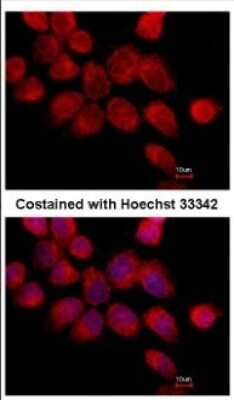 Immunocytochemistry/ Immunofluorescence: Transketolase Antibody [NBP2-20699]