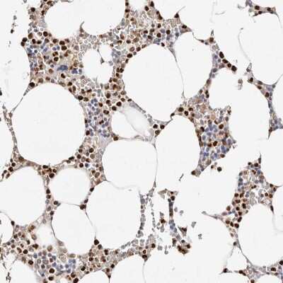 Immunohistochemistry-Paraffin: Transketolase Antibody [NBP1-87442]