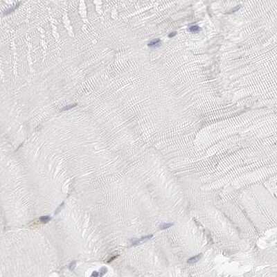 Immunohistochemistry-Paraffin: Transketolase Antibody [NBP1-87442]