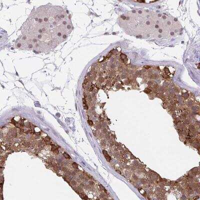 Immunohistochemistry-Paraffin: Translin Antibody [NBP2-31779]