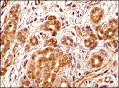 Immunohistochemistry-Paraffin: Transportin 1 Antibody (D45) - Azide and BSA Free [NBP2-80991]