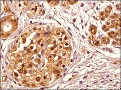 Immunohistochemistry-Paraffin: Transportin 1 Antibody (D45) - Azide and BSA Free [NBP2-80991]