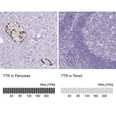 Immunohistochemistry-Paraffin: Transthyretin/Prealbumin Antibody (CL0290) [NBP2-52905]