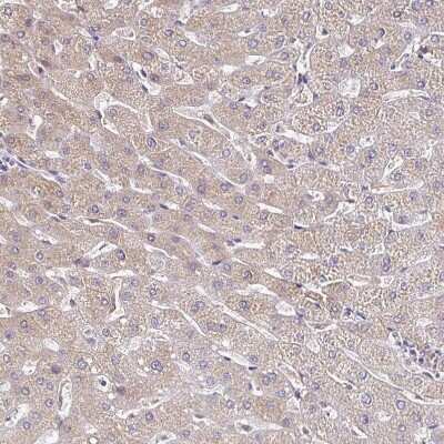 Immunohistochemistry-Paraffin: Transthyretin/Prealbumin Antibody [NBP1-89649]