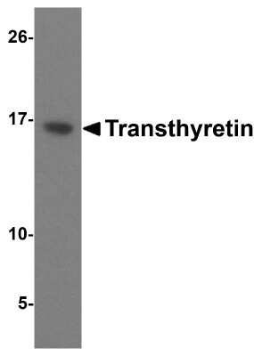 Western Blot: Transthyretin/Prealbumin AntibodyBSA Free [NBP2-41101]