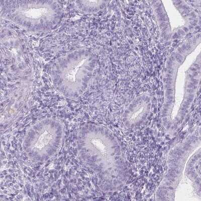Immunohistochemistry-Paraffin: Trappin-2/Elafin/Skalp Antibody [NBP1-85690]