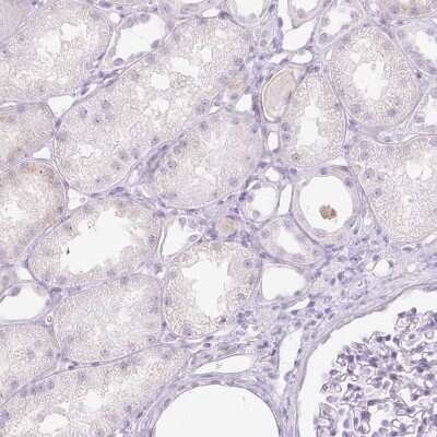 Immunohistochemistry-Paraffin: Trappin-2/Elafin/Skalp Antibody [NBP1-85690]