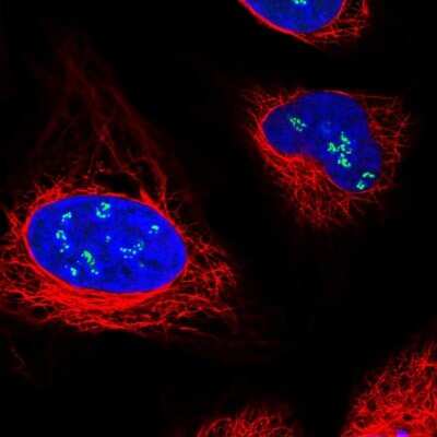 Immunocytochemistry/ Immunofluorescence: Treacher Collins syndrome protein Antibody [NBP1-86908]