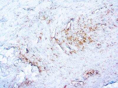 Immunohistochemistry-Paraffin: Treponema pallidum Antibody (2121) [NBP3-12169]