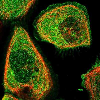 Immunocytochemistry/ Immunofluorescence: Triadin Antibody [NBP1-87417]