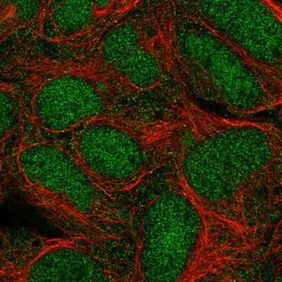 Immunocytochemistry/ Immunofluorescence: Trim11 Antibody [NBP2-55401]