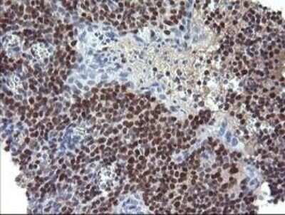 Immunohistochemistry: Trim22 Antibody (OTI1D11) - Azide and BSA Free [NBP2-74608]