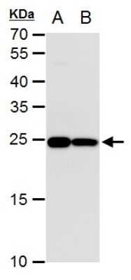 Western Blot: Triosephosphate isomerase Antibody (181) [NBP2-43761]