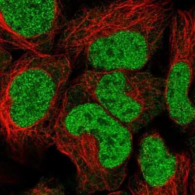 Immunocytochemistry/ Immunofluorescence: Triosephosphate isomerase Antibody [NBP2-58150]