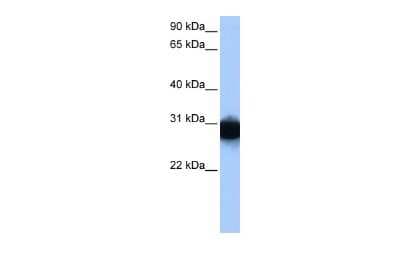 Western Blot: Triosephosphate isomerase Antibody [NBP1-52881]