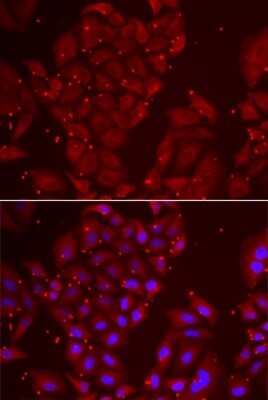 Immunocytochemistry/ Immunofluorescence: Tripeptidyl peptidase II Antibody - BSA Free [NBP2-93979]