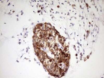 Immunohistochemistry: TrkA Antibody (OTI5B6) [NBP2-46266]