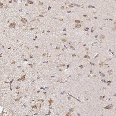 Immunohistochemistry-Paraffin: TrkA Antibody [NBP2-38265]