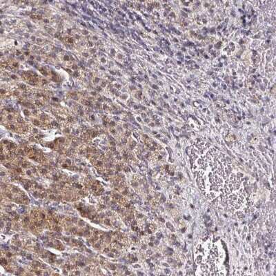 Immunohistochemistry-Paraffin: TrkA Antibody [NBP2-38265]