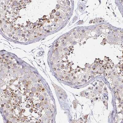 Immunohistochemistry-Paraffin: TrkA Antibody [NBP2-38265]