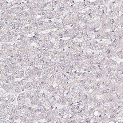 Immunohistochemistry-Paraffin: TrkA Antibody [NBP2-38265]