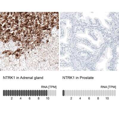 Immunohistochemistry-Paraffin: TrkA Antibody [NBP2-38265]