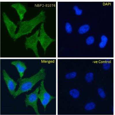 Immunocytochemistry/ Immunofluorescence: TrkA Antibody (MNAC13) - Chimeric - Azide and BSA Free [NBP2-81074]