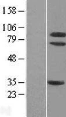 Western Blot: TrkA Overexpression Lysate [NBL1-13835]