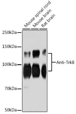 Western Blot: TrkB Antibody (1D7U4) [NBP3-15948]