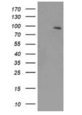 Western Blot: TrkB Antibody (OTI2E1) [NBP1-47898]
