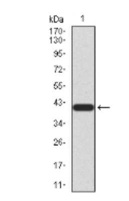 Western Blot: TrkB Antibody (8D2E8)BSA Free [NBP2-52523]